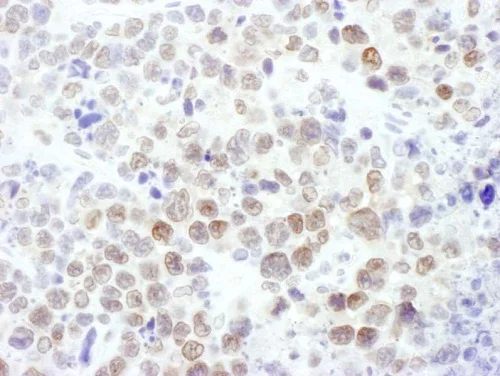 Immunohistochemistry (Formalin/PFA-fixed paraffin-embedded sections) - Anti-KMT6 / EZH2 antibody (AB186006)