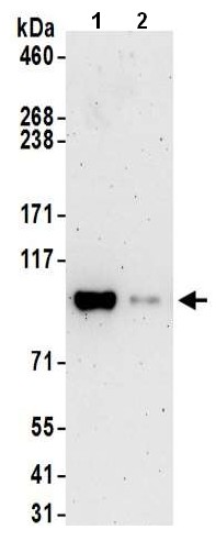 Immunoprecipitation - Anti-KMT6 / EZH2 antibody (AB186006), expandable thumbnail