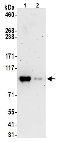 Immunoprecipitation - Anti-KMT6 / EZH2 antibody (AB186006)