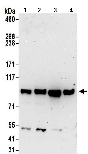 Western blot - Anti-KMT6 / EZH2 antibody (AB186006), expandable thumbnail