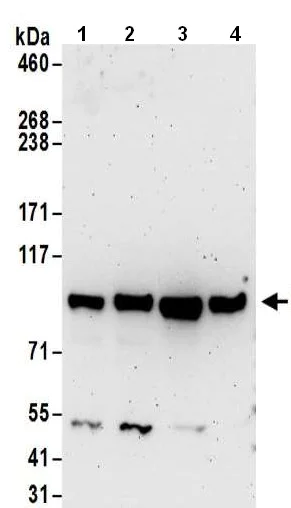 Western blot - Anti-KMT6 / EZH2 antibody (AB186006)