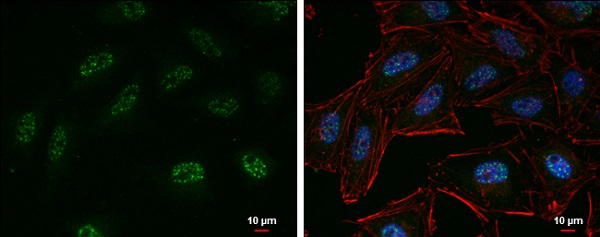 Immunocytochemistry/ Immunofluorescence - Anti-KMT6 / EZH2 antibody (AB228697), expandable thumbnail