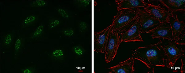 Immunocytochemistry/ Immunofluorescence - Anti-KMT6 / EZH2 antibody (AB228697)