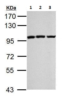 Western blot - Anti-KMT6 / EZH2 antibody (AB228697), expandable thumbnail