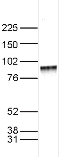 Western blot - Anti-KMT6 / EZH2 antibody - ChIP Grade (AB195409), expandable thumbnail