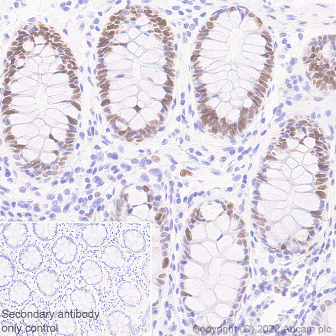 Immunohistochemistry (Formalin/PFA-fixed paraffin-embedded sections) - Anti-KMT6 / EZH2 antibody [EPR25353-284] (ab307646), expandable thumbnail