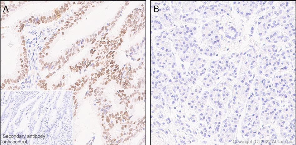 Immunohistochemistry (Formalin/PFA-fixed paraffin-embedded sections) - Anti-KMT6 / EZH2 antibody [EPR25353-284] (ab307646), expandable thumbnail