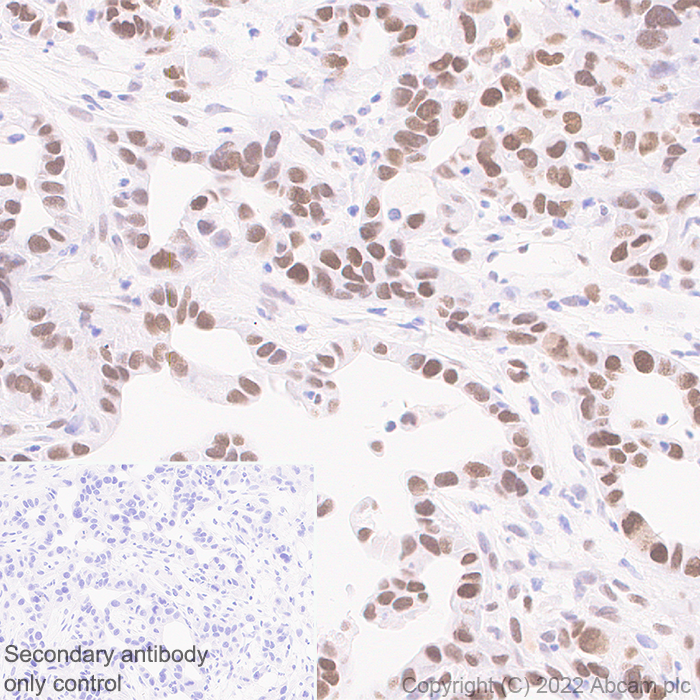Immunohistochemistry (Formalin/PFA-fixed paraffin-embedded sections) - Anti-KMT6 / EZH2 antibody [EPR25353-284] (ab307646), expandable thumbnail