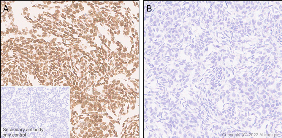 Immunohistochemistry (Formalin/PFA-fixed paraffin-embedded sections) - Anti-KMT6 / EZH2 antibody [EPR25353-284] (ab307646), expandable thumbnail