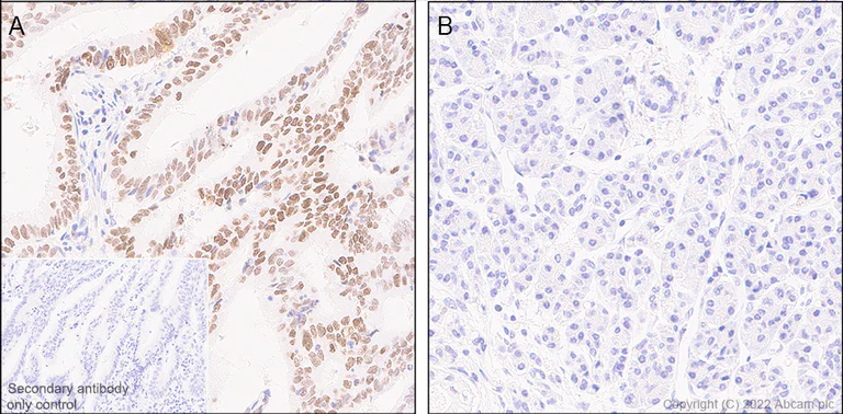 Immunohistochemistry (Formalin/PFA-fixed paraffin-embedded sections) - Anti-KMT6 / EZH2 antibody [EPR25353-284] - BSA and Azide free (AB307647)