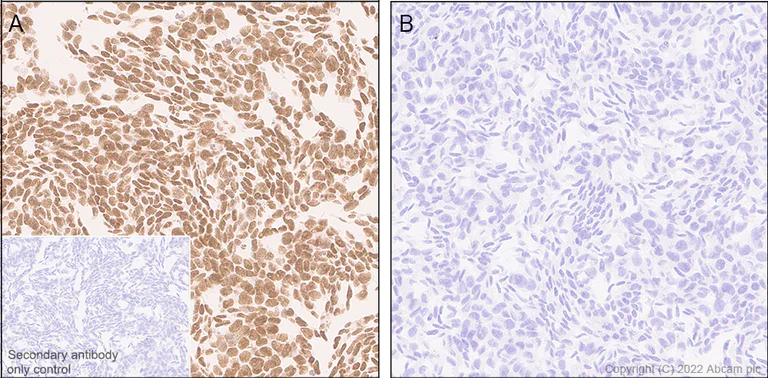Immunohistochemistry (Formalin/PFA-fixed paraffin-embedded sections) - Anti-KMT6 / EZH2 antibody [EPR25353-284] - BSA and Azide free (AB307647)