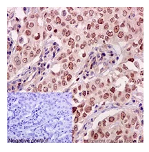 Immunohistochemistry (Formalin/PFA-fixed paraffin-embedded sections) - Anti-KMT6 / EZH2 antibody [EPR9307(2)] - BSA and Azide free (AB231165)