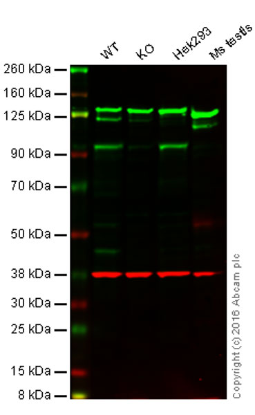 Western blot - Anti-KMT6 / EZH2 antibody [EPR9307(2)] - BSA and Azide free (AB231165), expandable thumbnail