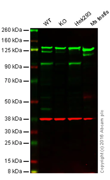 Western blot - Anti-KMT6 / EZH2 antibody [EPR9307(2)] - BSA and Azide free (AB231165)