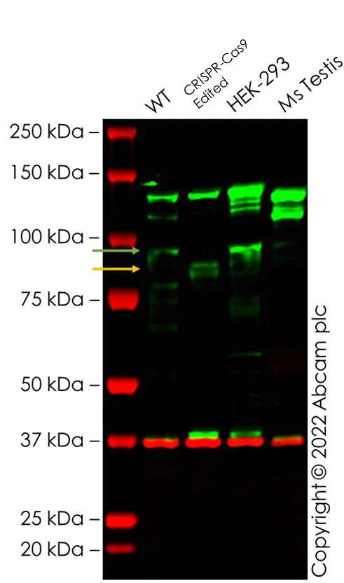 Western blot - Anti-KMT6 / EZH2 antibody [EPR9307(2)] - N-terminal (AB191080)