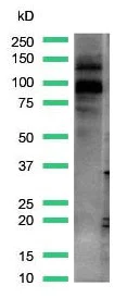 Western blot - Anti-KMT6 / EZH2 antibody [SP129] (AB227648)