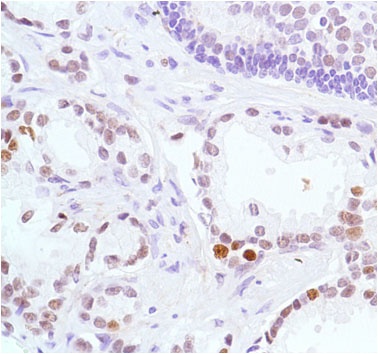 Immunohistochemistry (Formalin/PFA-fixed paraffin-embedded sections) - Anti-KMT6 / EZH2 antibody [SP129] - BSA and Azide free (AB245738), expandable thumbnail