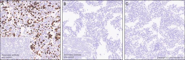 Immunohistochemistry (Formalin/PFA-fixed paraffin-embedded sections) - Anti-KMT6 / EZH2 (mutated Y646N) antibody [EPR24904-99] (AB300491)