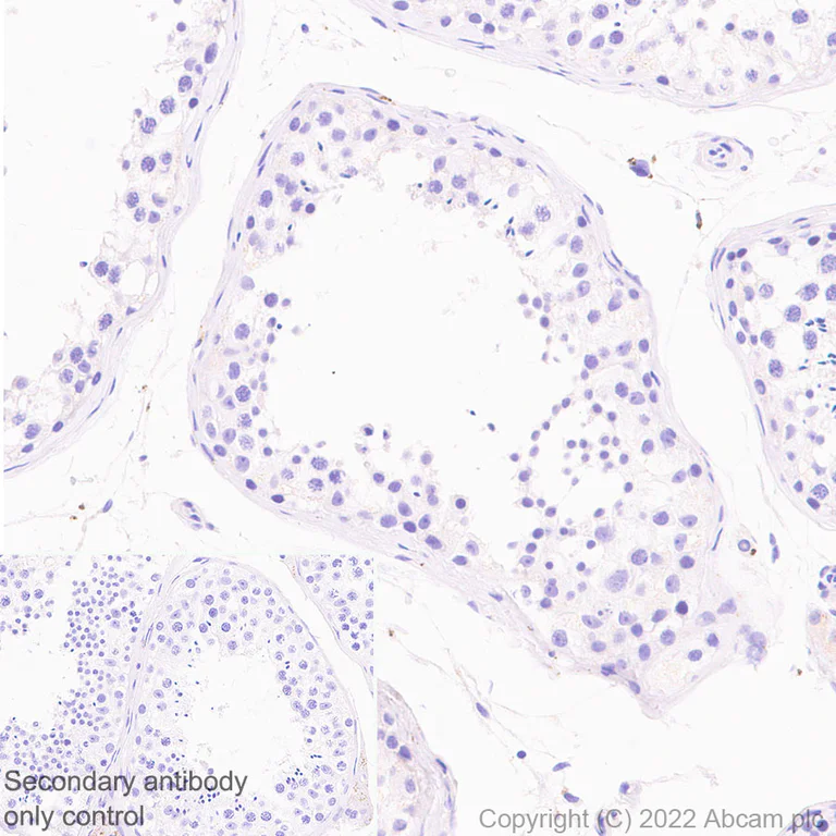 Immunohistochemistry (Formalin/PFA-fixed paraffin-embedded sections) - Anti-KMT6 / EZH2 (mutated Y646N) antibody [EPR24904-99] (AB300491)