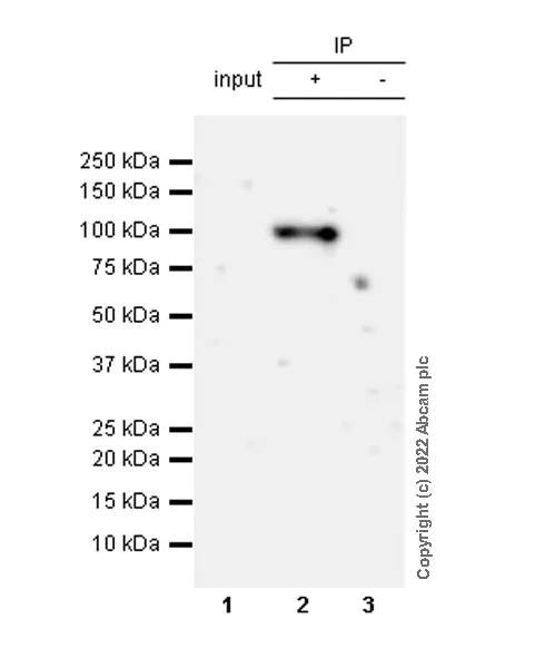 Immunoprecipitation - Anti-KMT6 / EZH2 (mutated Y646N) antibody [EPR24904-99] (AB300491)