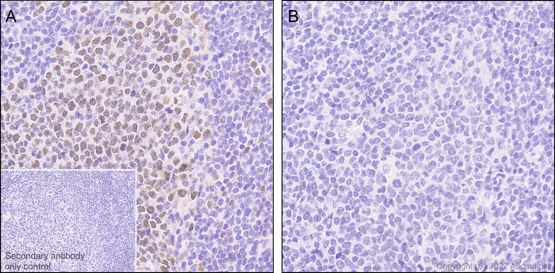 Immunohistochemistry (Formalin/PFA-fixed paraffin-embedded sections) - Anti-KMT6/EZH2 (phospho T487) antibody [EPR24903-104] (AB300567)