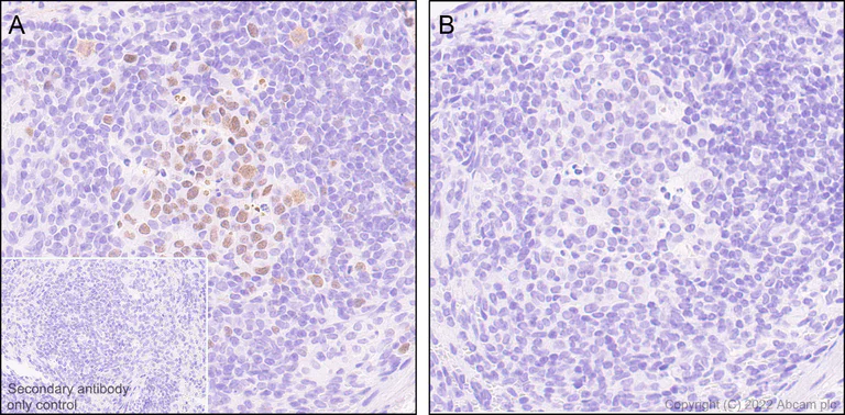 Immunohistochemistry (Formalin/PFA-fixed paraffin-embedded sections) - Anti-KMT6/EZH2 (phospho T487) antibody [EPR24903-104] (BSA and Azide free) (AB300568)