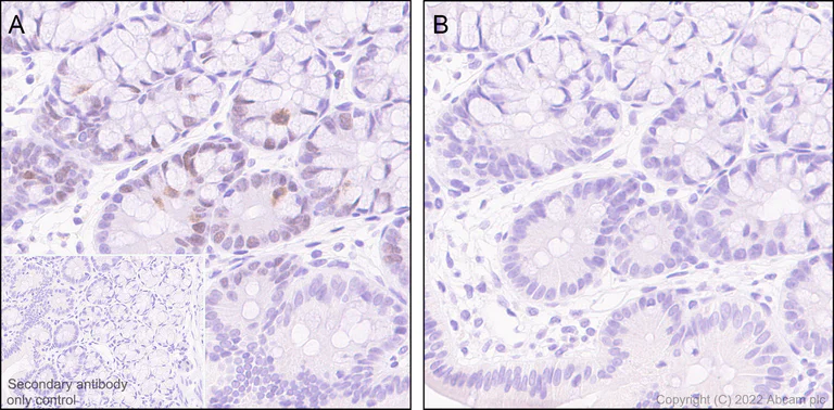 Immunohistochemistry (Formalin/PFA-fixed paraffin-embedded sections) - Anti-KMT6/EZH2 (phospho T487) antibody [EPR24903-104] (BSA and Azide free) (AB300568)