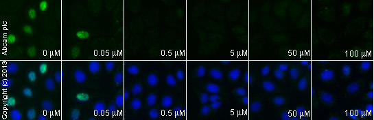 Immunocytochemistry/ Immunofluorescence - KN-93 (water soluble), CaMK II inhibitor (AB120980), expandable thumbnail
