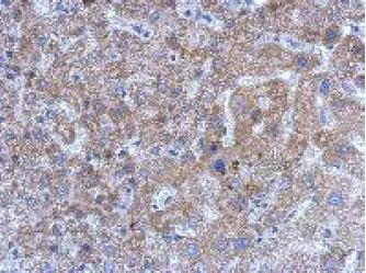 Immunohistochemistry (Formalin/PFA-fixed paraffin-embedded sections) - Anti-KPC2 antibody (AB151317)