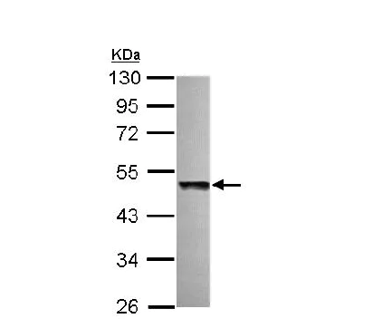Western blot - Anti-KPC2 antibody (AB151317)