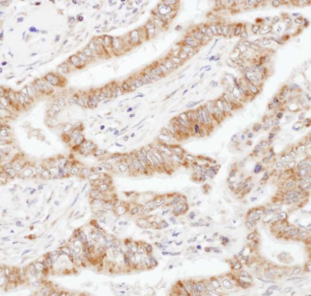 Immunohistochemistry (Formalin/PFA-fixed paraffin-embedded sections) - Anti-KPC2 antibody - C-terminal (AB177519)