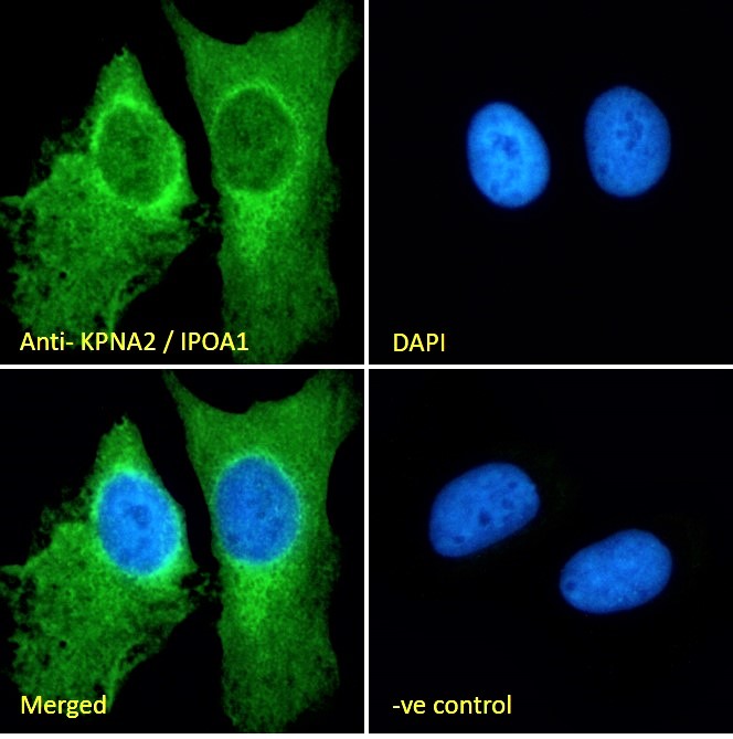 Immunocytochemistry/ Immunofluorescence - Anti-KPNA2 antibody (AB6036), expandable thumbnail