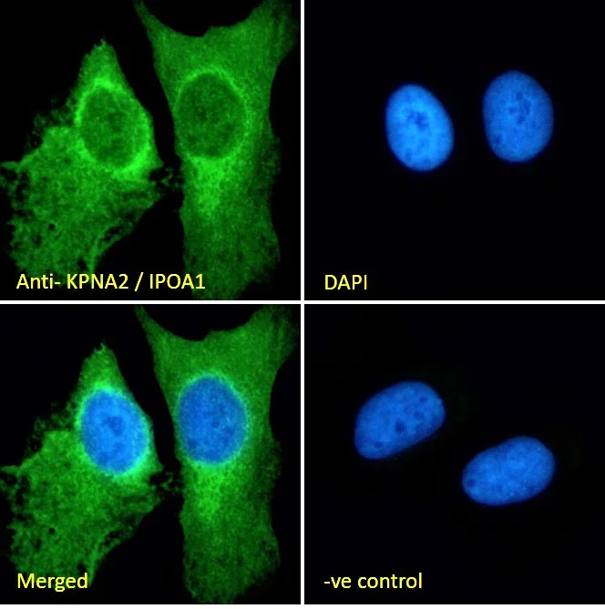 Immunocytochemistry/ Immunofluorescence - Anti-KPNA2 antibody (AB6036)