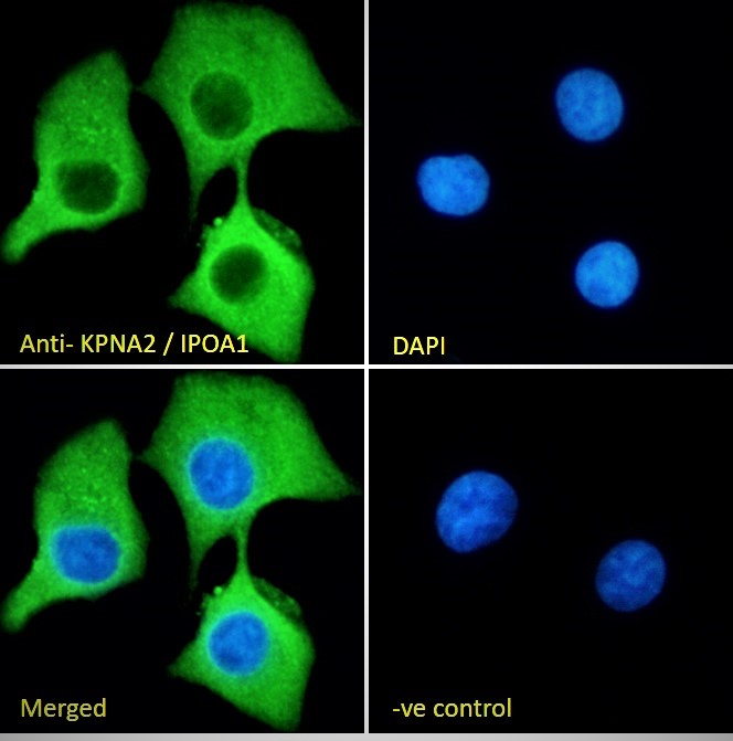Immunocytochemistry/ Immunofluorescence - Anti-KPNA2 antibody (AB6036), expandable thumbnail