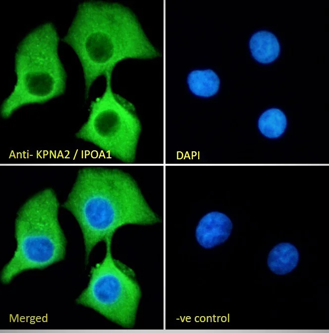 Immunocytochemistry/ Immunofluorescence - Anti-KPNA2 antibody (AB6036)