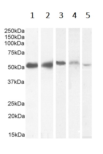 Western blot - Anti-KPNA2 antibody (AB6036), expandable thumbnail