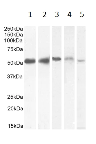 Western blot - Anti-KPNA2 antibody (AB6036)