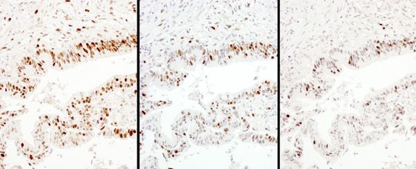 Immunohistochemistry (Formalin/PFA-fixed paraffin-embedded sections) - Anti-KPNA2 antibody (AB70160)