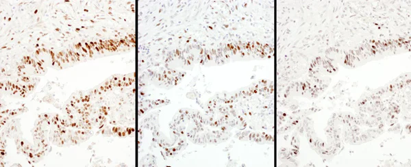 Immunohistochemistry (Formalin/PFA-fixed paraffin-embedded sections) - Anti-KPNA2 antibody (AB70160)