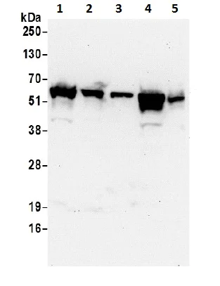 Western blot - Anti-KPNA2 antibody (AB70160)