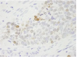 Immunohistochemistry (Formalin/PFA-fixed paraffin-embedded sections) - Anti-KPNA2 antibody (AB84440)