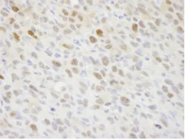 Immunohistochemistry (Formalin/PFA-fixed paraffin-embedded sections) - Anti-KPNA2 antibody (AB84440)