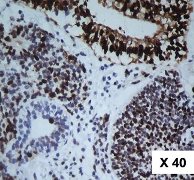 Immunohistochemistry (Formalin/PFA-fixed paraffin-embedded sections) - Anti-KPNA2 antibody (AB84440)