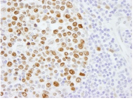 Anti-KPNA2 antibody