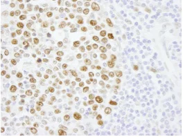 Immunohistochemistry (Formalin/PFA-fixed paraffin-embedded sections) - Anti-KPNA2 antibody (AB84440)