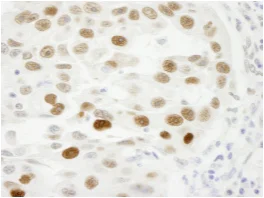 Immunohistochemistry (Formalin/PFA-fixed paraffin-embedded sections) - Anti-KPNA2 antibody (AB84440)