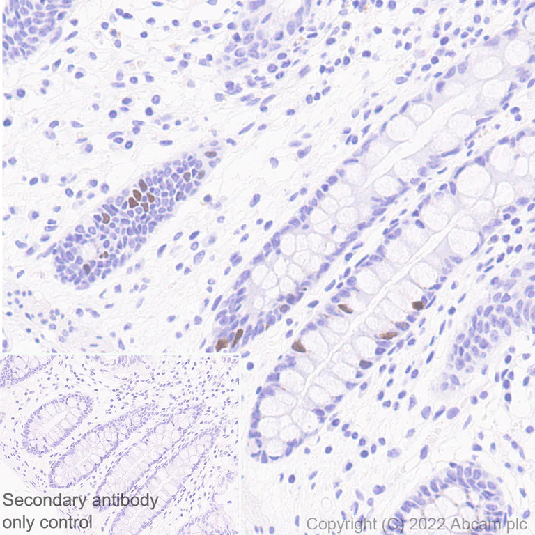 Immunohistochemistry (Formalin/PFA-fixed paraffin-embedded sections) - Anti-KPNA2 antibody [EPR25248-95] (AB289858)