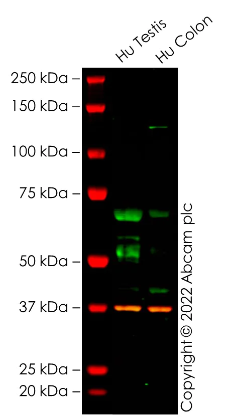 Western blot - Anti-KPNA2 antibody [EPR25248-95] - BSA and Azide free (AB289866)