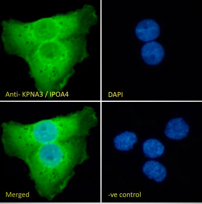 Immunocytochemistry/ Immunofluorescence - Anti-KPNA3 antibody (AB6038)