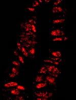 Immunocytochemistry/ Immunofluorescence - Anti-KPNA3 antibody (AB84706)
